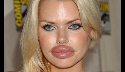 plastic-surgery-face--th