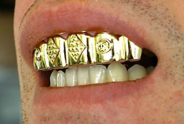 gold-teeth